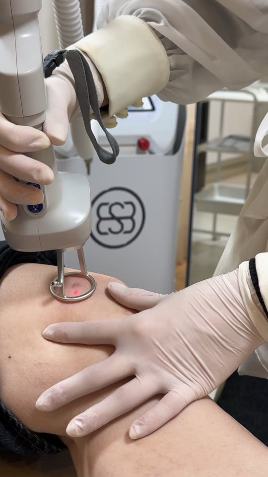 Laser Pisom em uso na pele do corpo