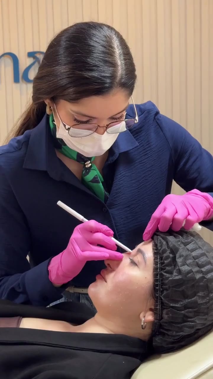 Dra. Beatriz fazendo a marcação no nariz de uma paciente antes da rinomodelação