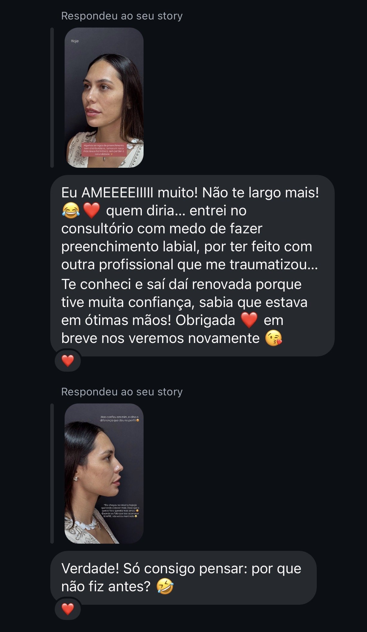 Mensagens de uma paciente respondendo aos stories da Dra. Beatriz, elogiando o preenchimento labial