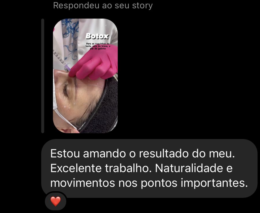 Mensagem de uma paciente elogiando a naturalidade do resultado da toxina botulínica